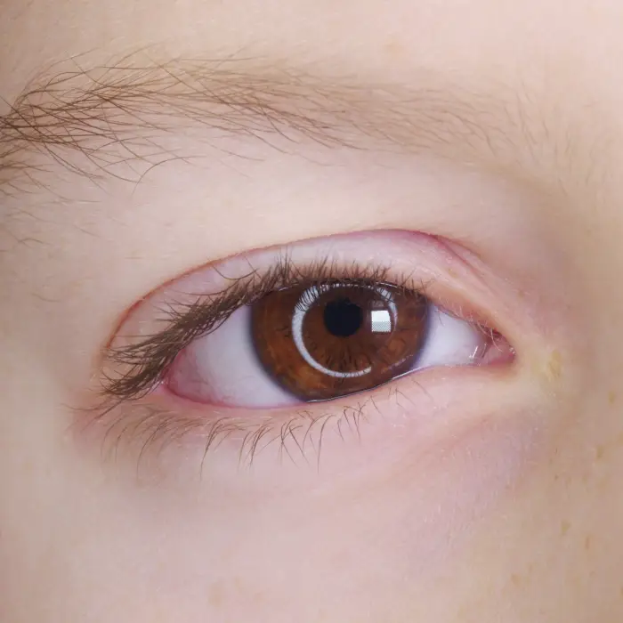 BetterVisionForChildren